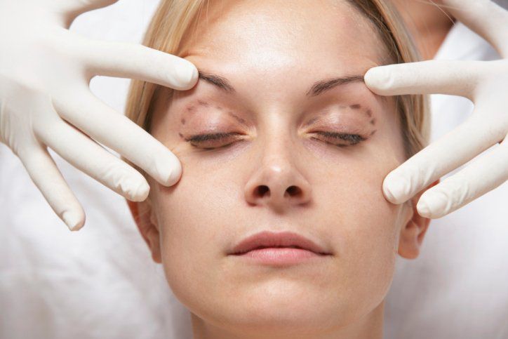 Você sabe o que é dermatocalase?