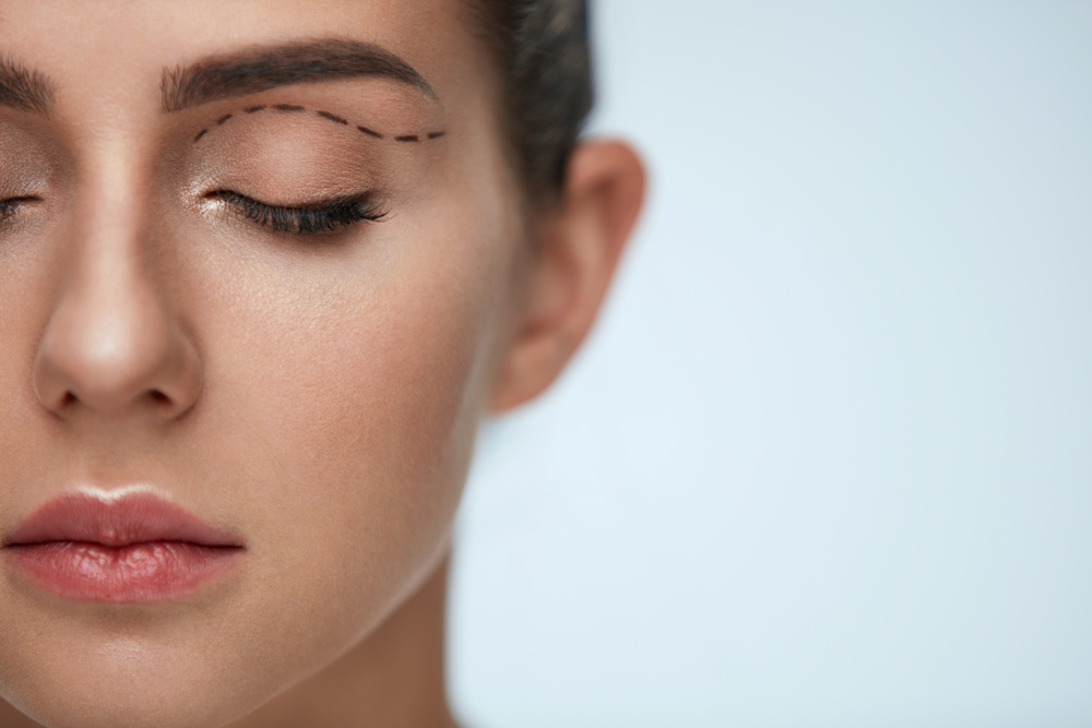 Dermatocálase é um problema estético ou reparador?