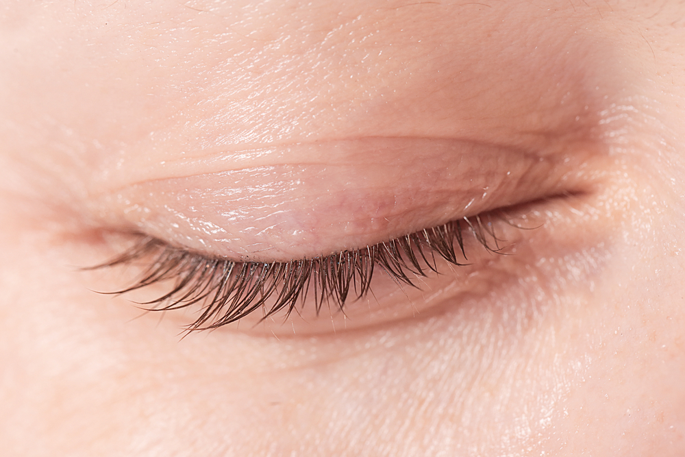 Tumores palpebrais malignos: quais os mais comuns