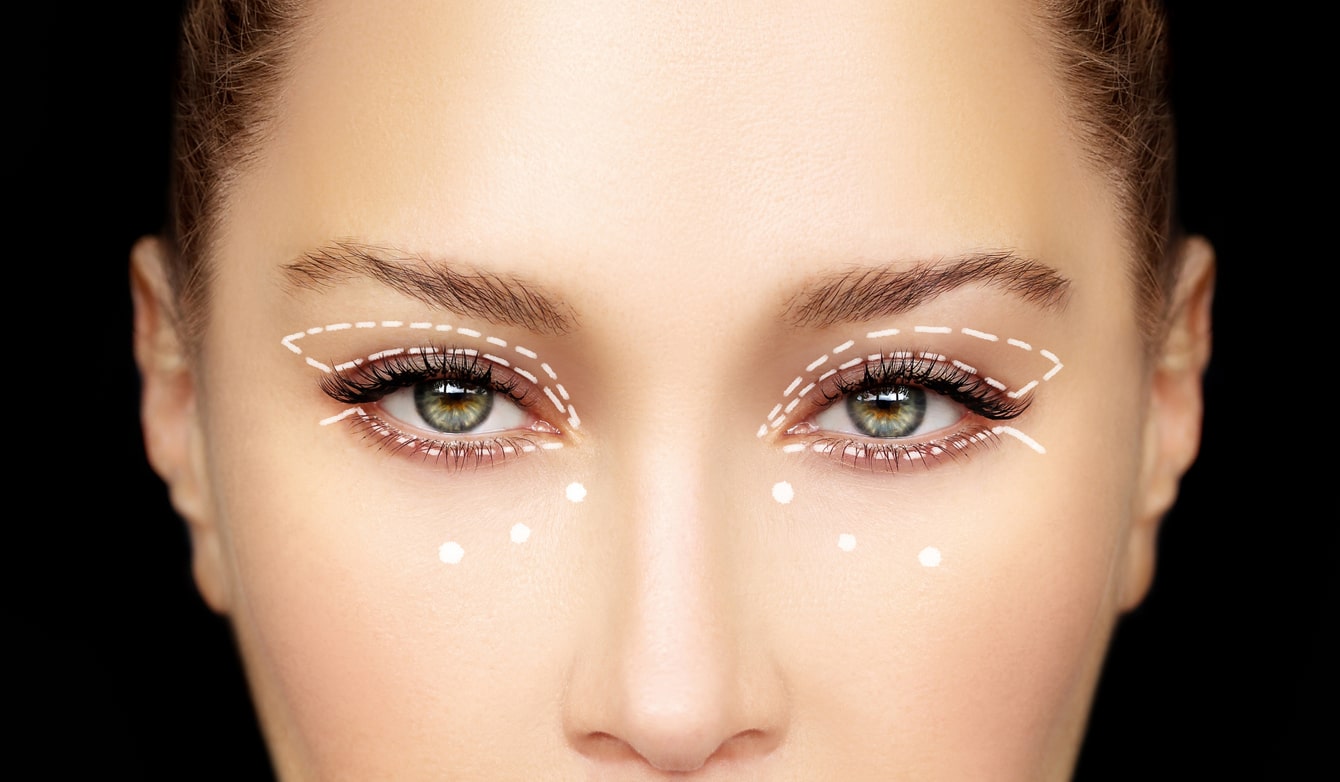 5 Benefícios Da Blefaroplastia