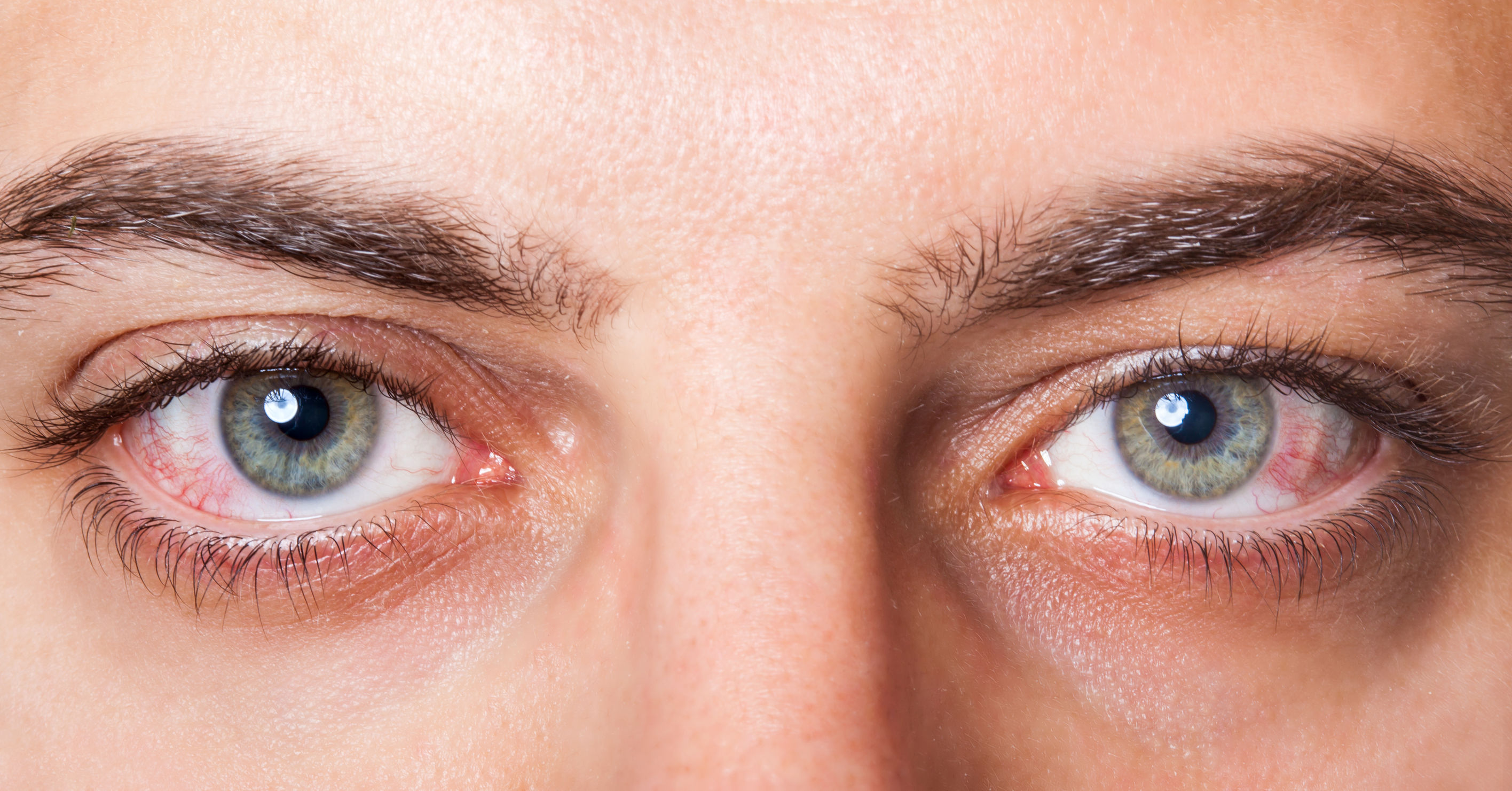 Exame de mapeamento de retina: qual a indicação e como é feito?