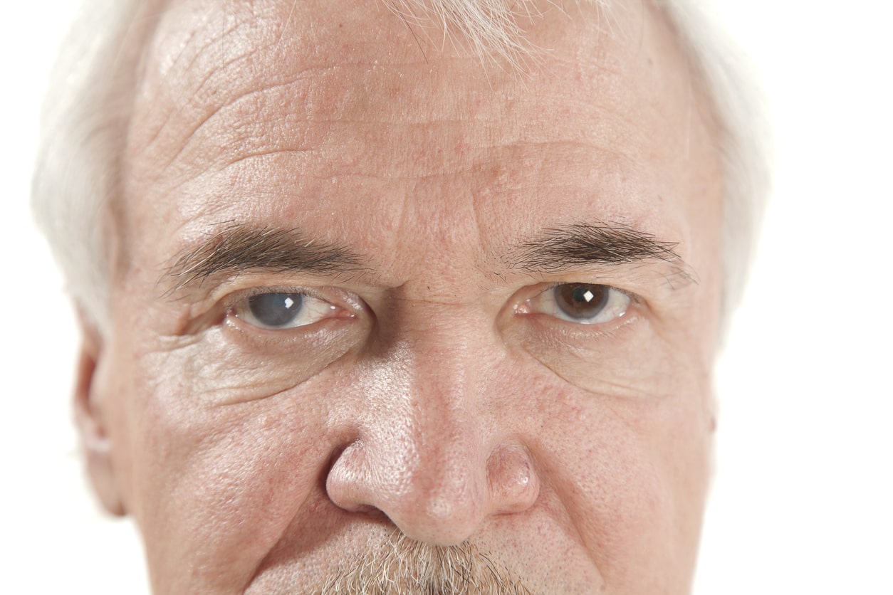 Tudo o que você precisa saber sobre glaucoma